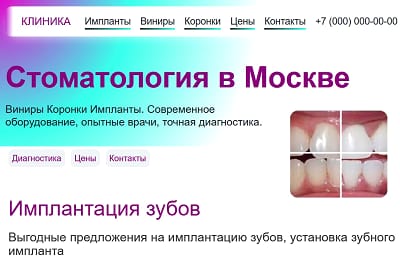 Дизайн сайта Стоматология, цена создание сайта под ключ